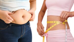 Professional Diet and Weight Management Services in Jodhpur Park and Jadavpur